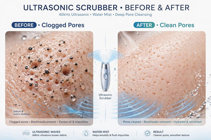 GLOWVA Ultrasonic Skin Scrubber - Deep Pore Cleanser & Serum Infuser